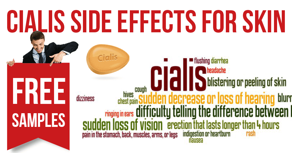 cialis side effects headache